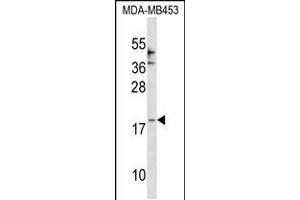 Image no. 1 for anti-Chemokine (C-C Motif) Ligand 25 (CCL25) (AA 66-95) antibody (ABIN5534713)