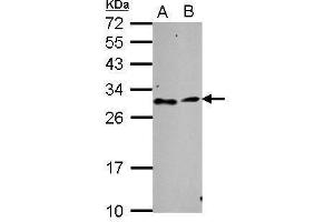 WB Image Sample (30 ug of whole cell lysate) A: NT2D1 B: SK-N-SH 12% SDS PAGE antibody diluted at 1:1000