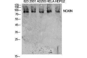 Image no. 1 for anti-Chromosome 11 Open Reading Frame 82 (C11orf82) (Internal Region) antibody (ABIN3181418)