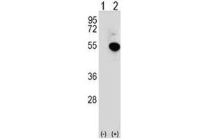 Image no. 3 for anti-Interferon Regulatory Factor 4 (IRF4) (AA 164-191) antibody (ABIN3031420)