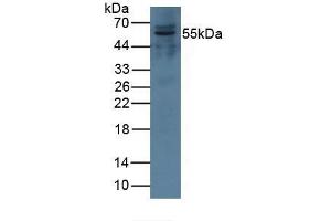 Complement Factor I Antikörper  (AA 28-243)