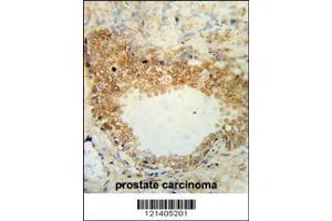 Immunohistochemistry (IHC) image for anti-Desmocollin 1 (DSC1) antibody (ABIN2158601)