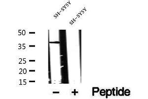 Image no. 3 for anti-CXXC Finger Protein 5 (CXXC5) antibody (ABIN6261130)