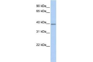 Image no. 4 for anti-Thioredoxin Interacting Protein (TXNIP) (C-Term) antibody (ABIN2784817)