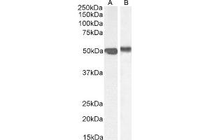 Image no. 5 for anti-Forkhead Box A1 (FOXA1) (C-Term) antibody (ABIN185021)