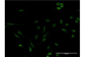 anti-Gem (Nuclear Organelle) Associated Protein 4 (GEMIN4) (AA 959-1057) antibody