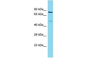 Image no. 1 for anti-DENN/MADD Domain Containing 1C (DENND1C) (C-Term) antibody (ABIN2790995)