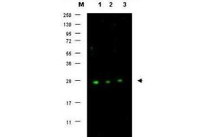 Western blot using  affinity purified anti-p27 antibody shows detection of p27 protein in MCF7 whole cell lysate (lanes 1-3) (arrowhead).