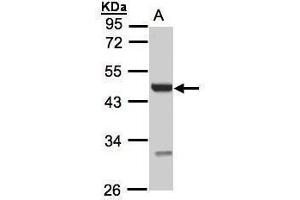 Image no. 2 for anti-Uronyl-2-Sulfotransferase (UST) (Center) antibody (ABIN2856033)