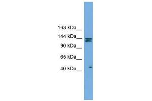 Image no. 1 for anti-Isoleucyl-tRNA Synthetase (IARS) (Middle Region) antibody (ABIN631746)