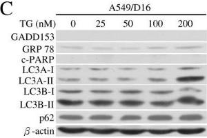 Image no. 12 for anti-Sequestosome 1 (SQSTM1) (Internal Region) antibody (ABIN2854836)
