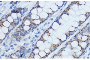 Immunohistochemistry of paraffin-embedded Human colon using Aromatase Polyclonal Antibody at dilution of 1:100 (40x lens).