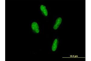 Image no. 3 for anti-SP110 Nuclear Body Protein (SP110) (AA 1-547) antibody (ABIN948008)