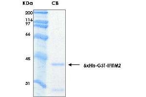 Image no. 1 for Interferon Induced Transmembrane Protein 2 (IFITM2) (AA 1-132) protein (His-GST) (ABIN2703620)