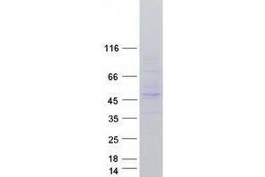 Image no. 1 for Tripartite Motif Containing 13 (TRIM13) (Transcript Variant 3) protein (Myc-DYKDDDDK Tag) (ABIN2734224)