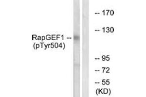 Image no. 1 for anti-Rap Guanine Nucleotide Exchange Factor (GEF) 1 (RAPGEF1) (AA 470-519), (pTyr504) antibody (ABIN1531697)