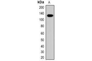 Image no. 1 for anti-Collagen, Type IV, alpha 1 (COL4A1) (C-Term) antibody (ABIN3222767)