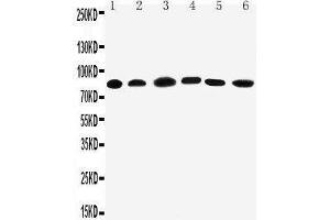 Image no. 1 for anti-Proprotein Convertase Subtilisin/kexin Type 1 (PCSK1) (AA 726-740), (C-Term) antibody (ABIN3044077)