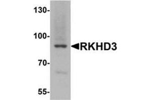 Image no. 2 for anti-Mex-3 Homolog B (MEX3B) (Middle Region) antibody (ABIN1450108)