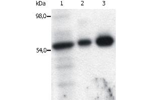Image no. 4 for anti-FYN Oncogene Related To SRC, FGR, YES (FYN) (AA 7-176) antibody (ABIN94311)