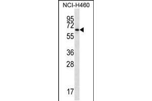 Image no. 1 for anti-Zinc Finger Protein 340 (ZNF340) (AA 251-279) antibody (ABIN5536942)