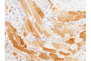 Image no. 1 for anti-Protein Phosphatase, Mg2+/Mn2+ Dependent, 1G (PPM1G) (AA 317-546) antibody (ABIN1998581)