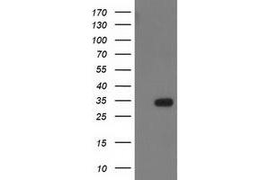 Image no. 1 for anti-Haloacid Dehalogenase-Like Hydrolase Domain Containing 2 (HDHD2) antibody (ABIN2722545)