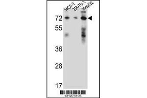 Image no. 1 for anti-Hydroxysteroid (17-Beta) Dehydrogenase 4 (HSD17B4) (AA 341-370) antibody (ABIN656447)