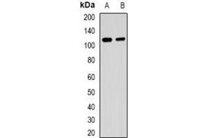 Image no. 2 for anti-Mucosa Associated Lymphoid Tissue Lymphoma Translocation Gene 1 (MALT1) antibody (ABIN3198189)