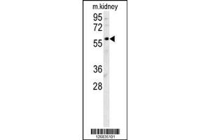 Western Blotting (WB) image for anti-DNA Cross-Link Repair 1B (DCLRE1B) antibody (ABIN2158493)