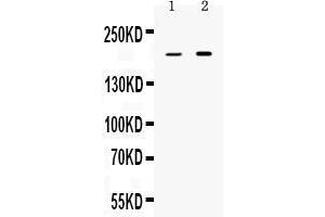 Image no. 1 for anti-Periplakin (PPL) (AA 1664-1701), (C-Term) antibody (ABIN5518787)