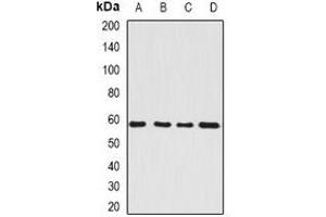 Image no. 3 for anti-Seryl-tRNA Synthetase (SARS) antibody (ABIN2967023)