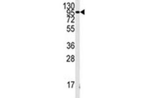 Image no. 2 for anti-Fibroblast Growth Factor Receptor 1 (FGFR1) (AA 132-161) antibody (ABIN3029719)