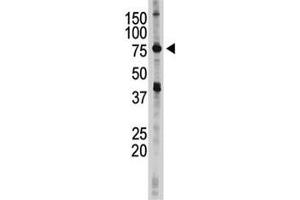Image no. 2 for anti-Inhibitor of kappa Light Polypeptide Gene Enhancer in B-Cells, Kinase epsilon (IKBKE) (AA 686-716) antibody (ABIN3031322)