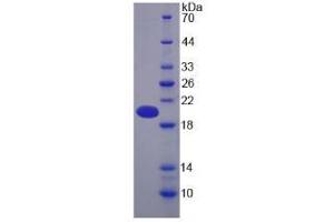 Image no. 1 for Pregnancy Zone Protein (PZP) (AA 1212-1391) protein (His tag) (ABIN1171179)