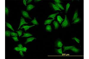 Image no. 6 for anti-NIMA (Never in Mitosis Gene A)- Related Kinase 9 (NEK9) (AA 226-326) antibody (ABIN566652)