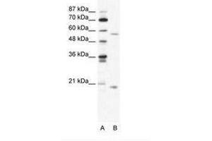 Image no. 1 for anti-Zinc Finger Protein 18 (ZNF18) (N-Term) antibody (ABIN202745)