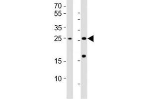 RHOXF1 antibody  (AA 85-120)