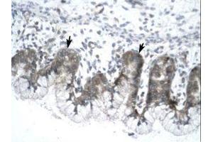 Image no. 1 for anti-Influenza Virus NS1A Binding Protein (IVNS1ABP) (N-Term) antibody (ABIN203235)