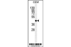 Image no. 1 for anti-Vascular Endothelial Growth Factor C (VEGFC) antibody (ABIN659094)
