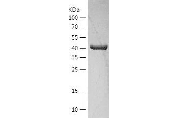 OXSM Protein (AA 28-459) (His tag)