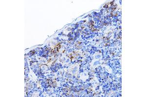 LCK antibody  (AA 1-240)