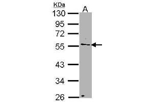 Image no. 3 for anti-Nucleoporin 50kDa (NUP50) (C-Term) antibody (ABIN2856374)