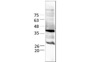 Image no. 3 for LINE1 Retrotransposable Element 1 (L1RE1) (AA 1-338) protein (His tag) (ABIN3083185)
