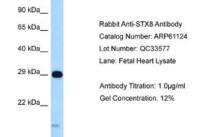 Image no. 1 for anti-Syntaxin 8 (STX8) (C-Term) antibody (ABIN2788685)