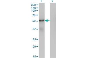 Western Blot analysis of SNX25 expression in transfected 293T cell line by SNX25 monoclonal antibody (M01), clone 3A8.