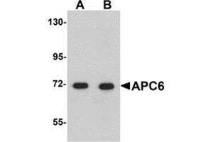 Image no. 1 for anti-Cell Division Cycle 16 Homolog (S. Cerevisiae) (CDC16) (N-Term) antibody (ABIN499301)