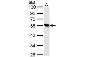Image no. 1 for anti-Transglutaminase 4 (Prostate) (TGM4) (Center) antibody (ABIN2854553)