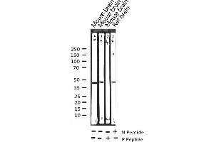 Image no. 1 for anti-CCAAT/enhancer Binding Protein (C/EBP), alpha (CEBPA) (pSer21) antibody (ABIN6256190)