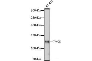 Tmc5 antibody